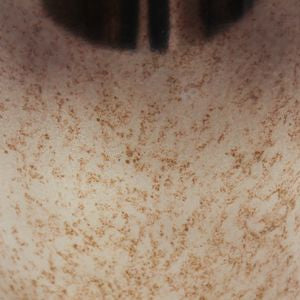26" Feist Small Urn W Topper